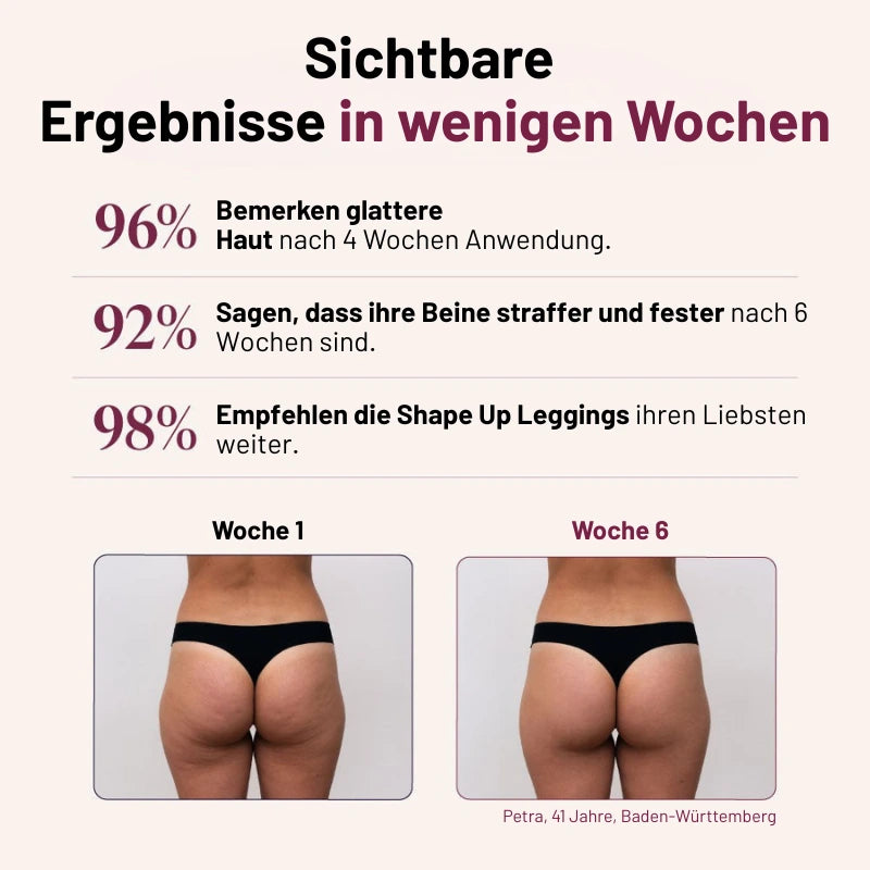 3D Anti-Cellulite-Leggings - Formen Sie Ihre Silhouette mühelos neu