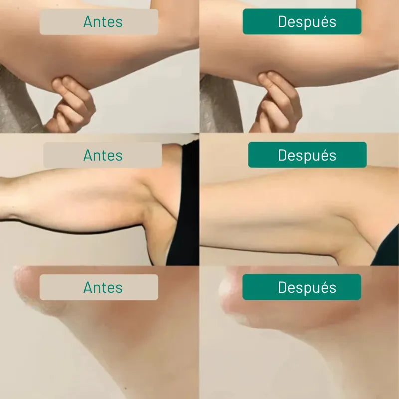 Drenaje Linfático - Rostro Afinado, Piernas Ligeras, Vientre Plano