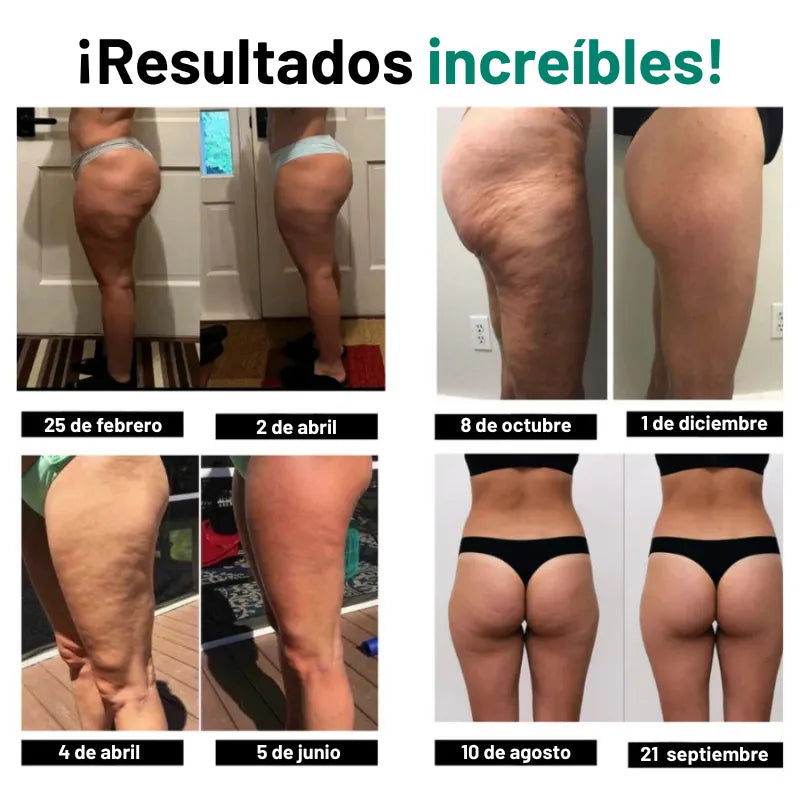 Drenaje Linfático - Rostro Afinado, Piernas Ligeras, Vientre Plano